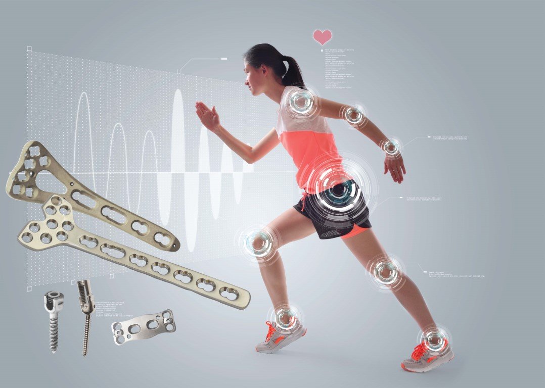 The benefits of orthopedic implants and instruments